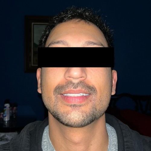 Shane123: Swingers Hotwife Cuckold