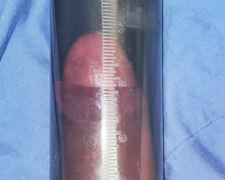 Swinger Hotwife Cuckold Worcester - DaveandLeah