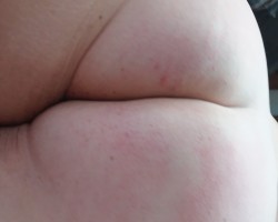  - Drtcpl69 Photo
