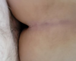 - Hardnadmirable Photo